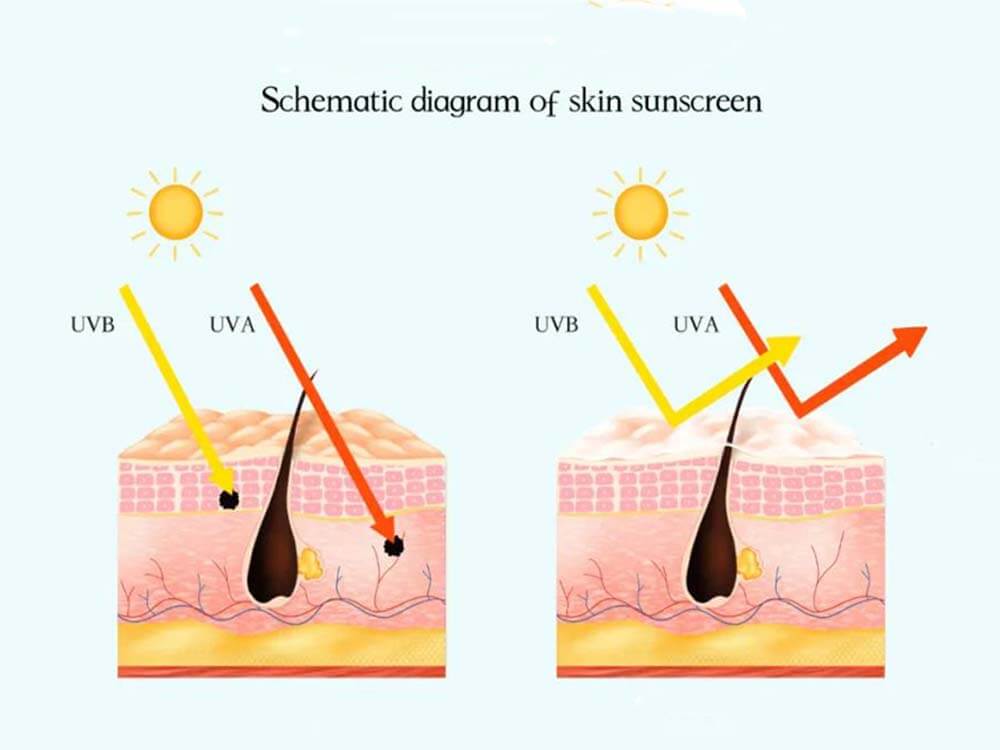 How to Prevent Sun Protection